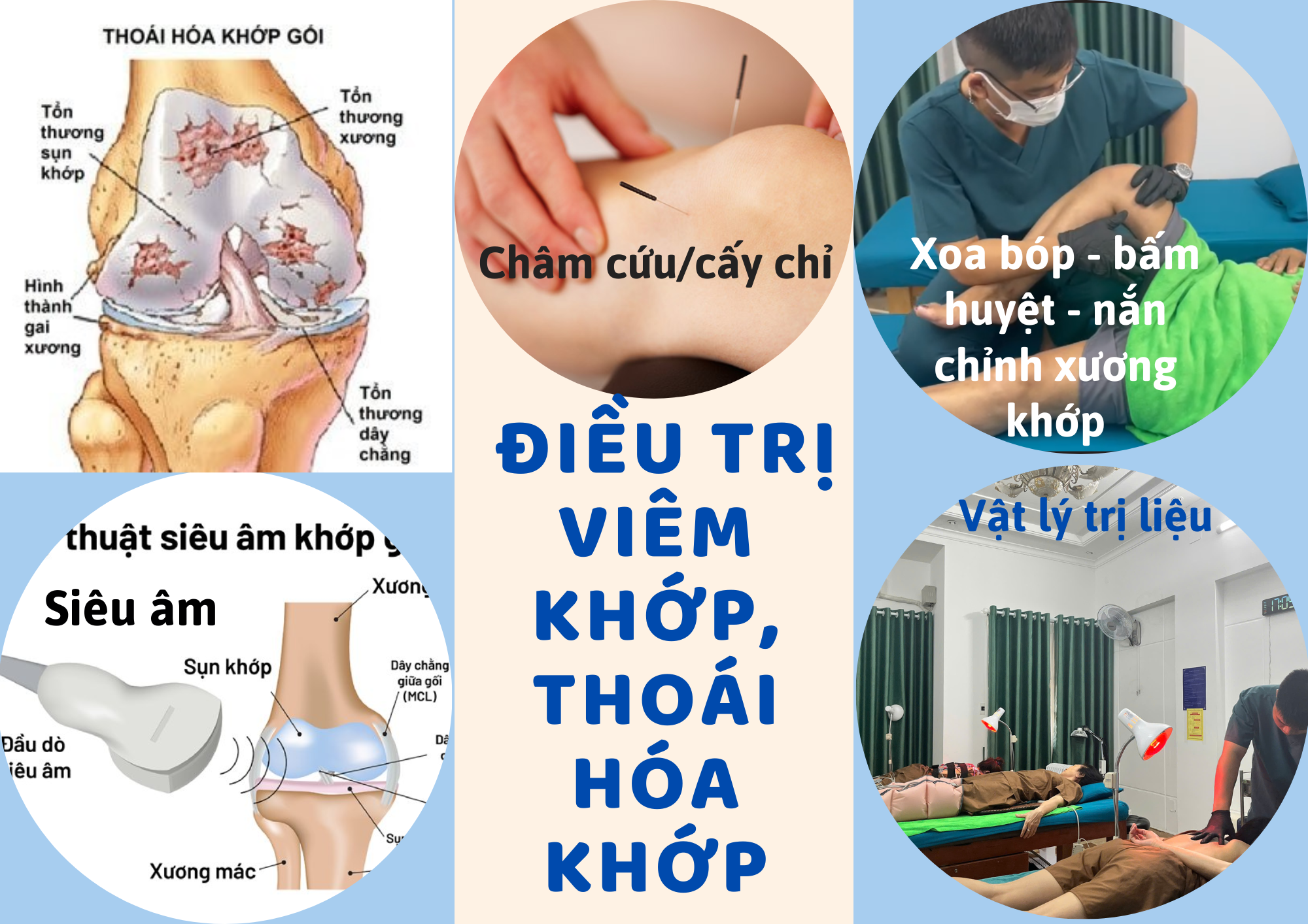 Điều trị thoái hóa khớp